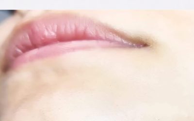 Chin Hair in Women: What It Could Mean for Your Health