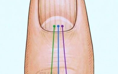 If You Have Lines on Your Nails, Here’s What Your Body Might Be Telling You