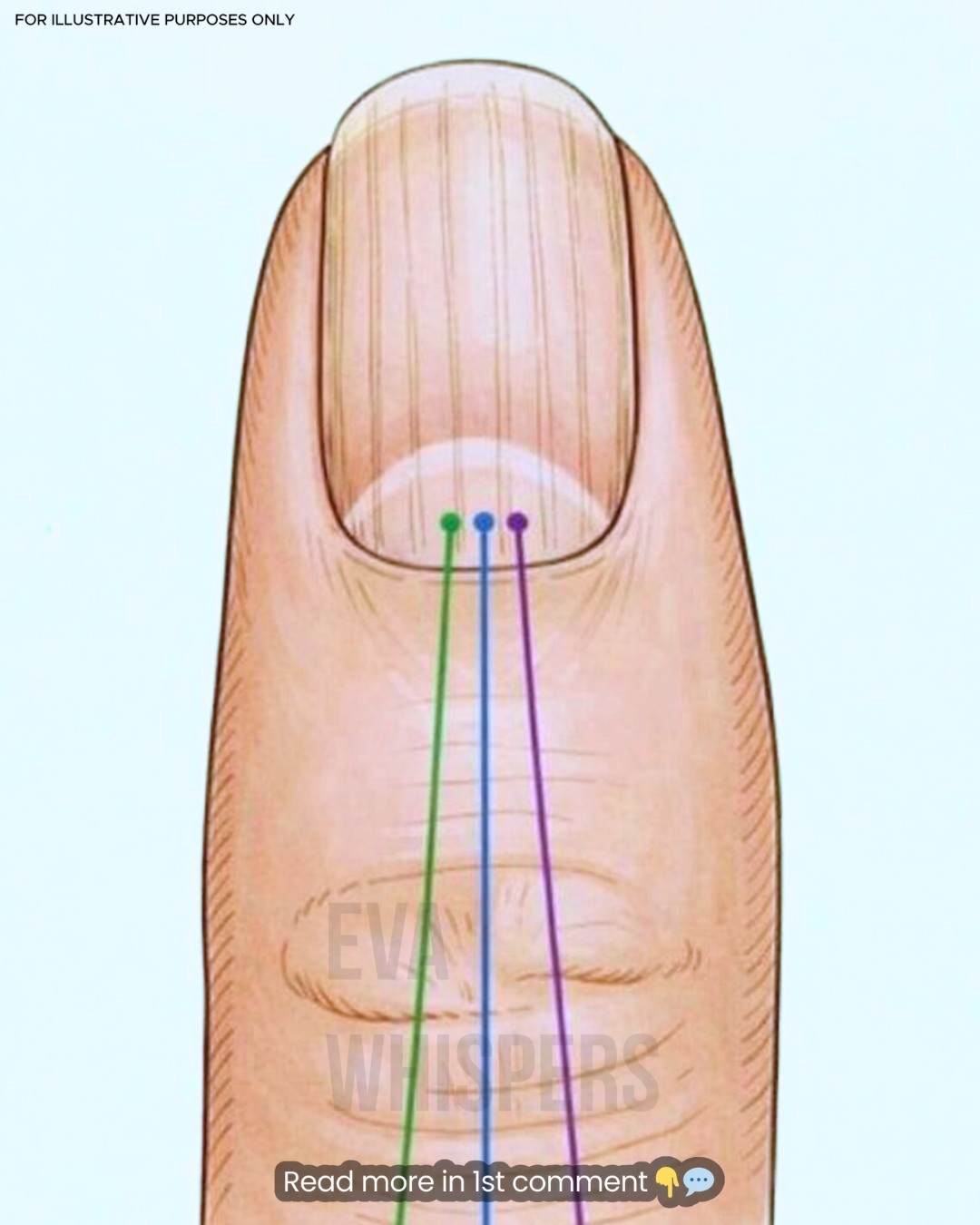 If You Have Lines on Your Nails, Here’s What Your Body Might Be Telling You