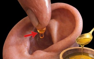 Natural Remedies for Earache and Ear Infections: Safe Ways to Find Comfort at Home