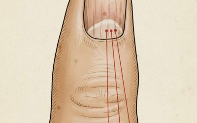 If you have these lines on your nails, you should pay attention.