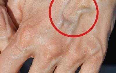 Visible Veins What They Mean and Why You Might See Them