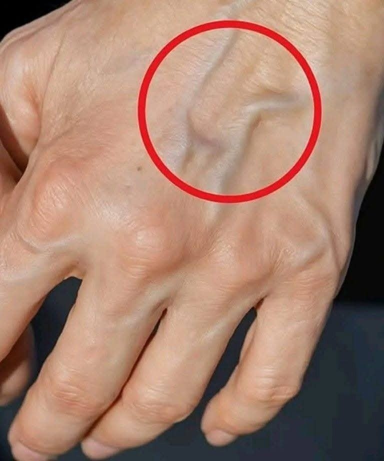 Do visible veins mean poor circulation?
