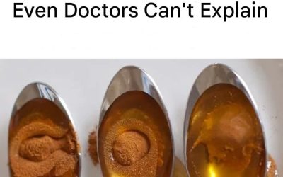 Cinnamon and Honey: The Most Powerful Remedy Even Doctors Can’t Explain