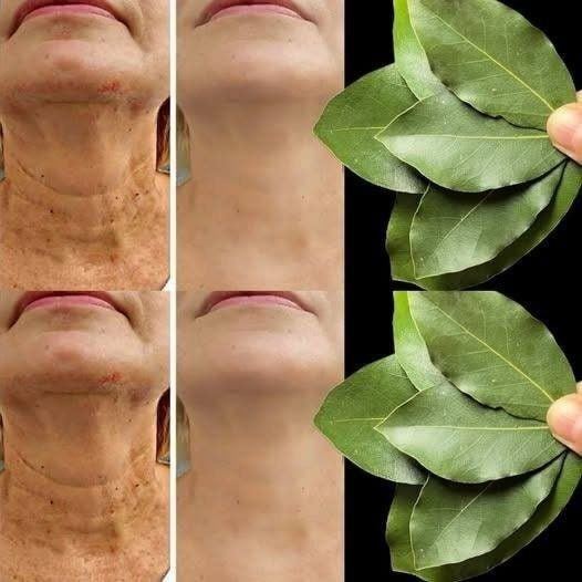 Bay leaves are 100,000 times stronger than Botox? | Natural wrinkle remover even at 70!
