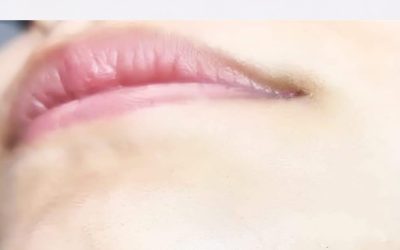 Chin Hair in Women: What It Could Mean for Your Health