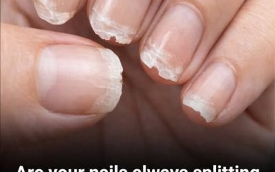 Brittle or Weak Nails? Your Body Might Be Trying to Tell You Something…