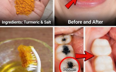 Turmeric for Teeth: Can This “Golden Spice” Really Whiten Your Smile?