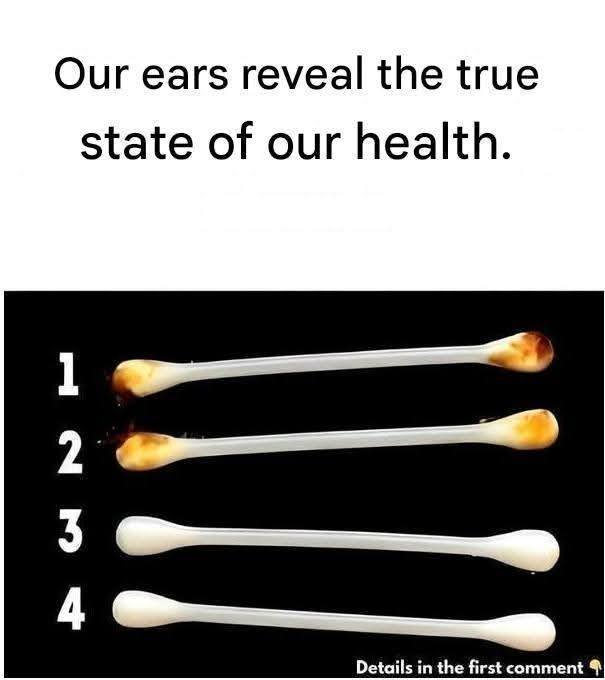Our ears reveal the true state of our health
