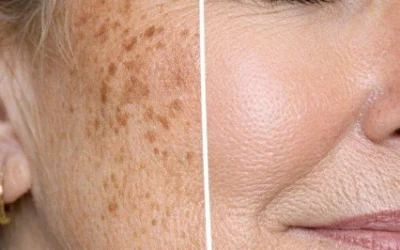 The 5-Minute Sun Spot Cover-Up Trick My Sister Swears By (Zero Effort, Maximum Results!)