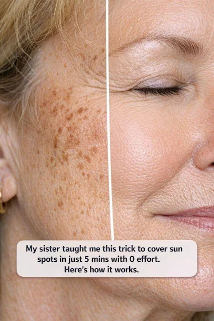 The 5-Minute Sun Spot Cover-Up Trick My Sister Swears By (Zero Effort, Maximum Results!)
