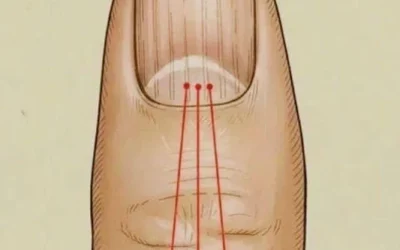 What to Eat to Reduce Nail Ridges: A Nutrition Guide for Healthier, Stronger Nails