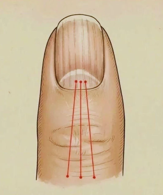 What to Eat to Reduce Nail Ridges: A Nutrition Guide for Healthier, Stronger Nails