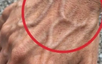 If you have visible veins, it means you are…