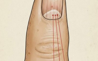 If you have these lines on your nails, you should pay attention.