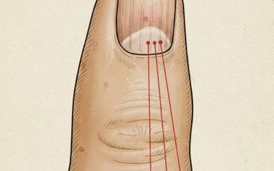 If you have these lines on your nails, you should pay attention.