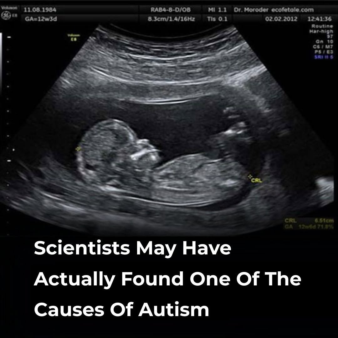 Scientists Explore a Potential Link Between Maternal Gut Health and Autism—But Here’s What We Actually Know