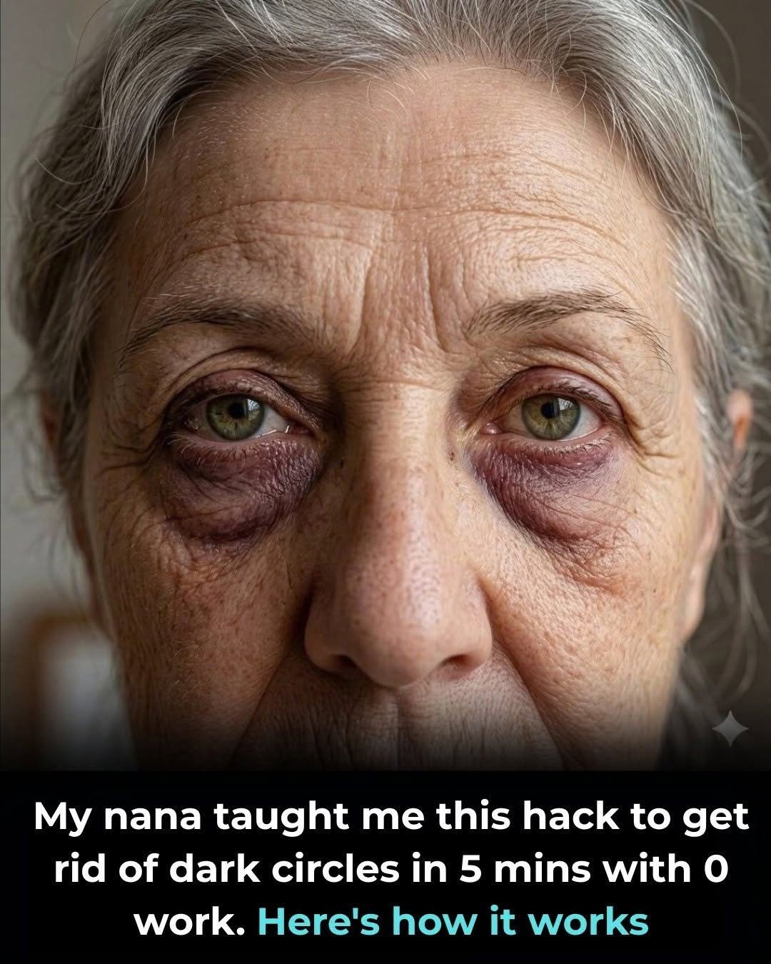 My nana taught me this hack to get rid of dark circles in 5 mins with 0 work. Here’s how it works