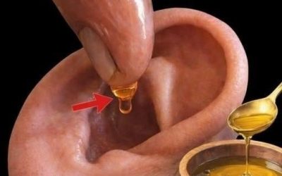 Natural Remedies for Earache and Ear Infections: Safe Ways to Find Comfort at Home