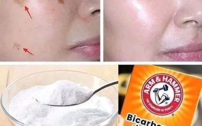 4 Ways to Erase Age Spots with Baking Soda for Younger, More Even Skin