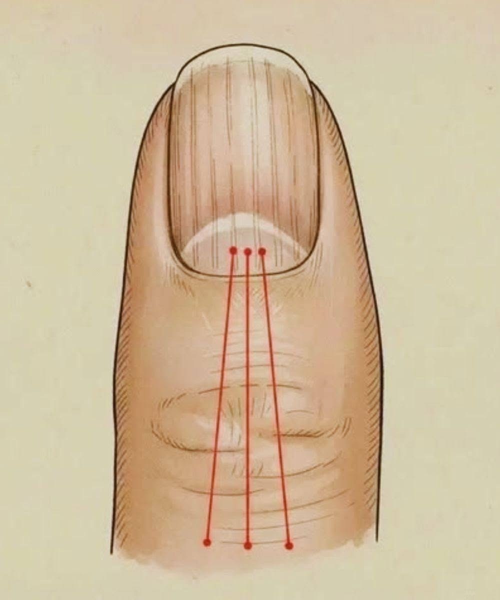 What to Eat to Reduce Nail Ridges: A Nutrition Guide for Healthier Nails