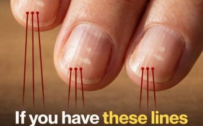 Foods That Support Stronger Nails After 40