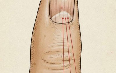 If you have these lines on your nails, you should pay attention.