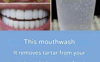 A natural method for removing tartar