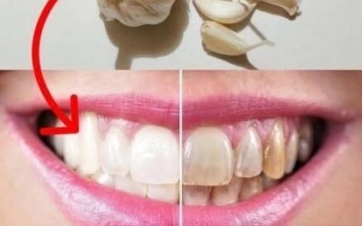 Dentists will hate that you know this trick 😳 🦷