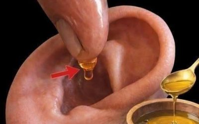 Natural Remedies for Earache and Ear Infections: Safe Ways to Find Comfort at Home