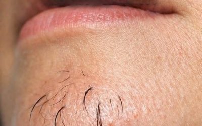 A woman’s chin hair is a sign of…See more