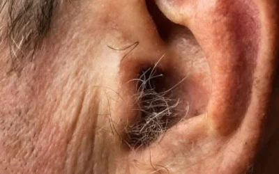 Did You Know That Hair Growing on Your Ears Is a Completely Normal Part of Aging?