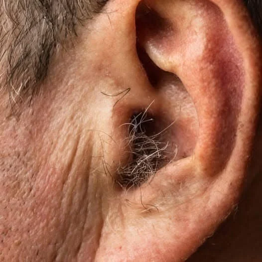 Did You Know That Hair Growing on Your Ears Is a Completely Normal Part of Aging?