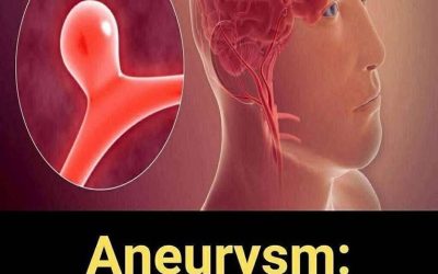 12 Signs That May Signal a Brain Aneurysm — Don’t Ignore Them
