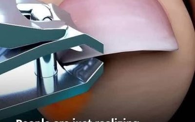 Are You Cutting Your Toenails Wrong? Discover the Right Way