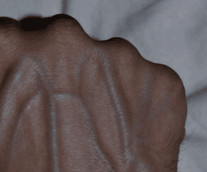 Visible Veins Explained: Normal Causes, Health Risks, and When to Worry